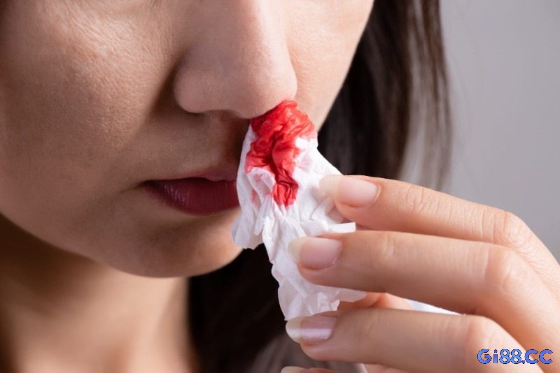 Đối với chảy máu mũi người chơi nên chọn cặp số 27 hoặc 72