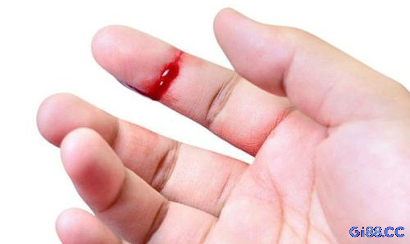 Số liệu thống kê từ các trường hợp thực tế hiện tượng chảy máu