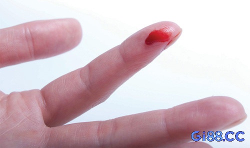 Cùng gi88 khám phá hiện tượng chảy máu đánh con lô gì nhé!